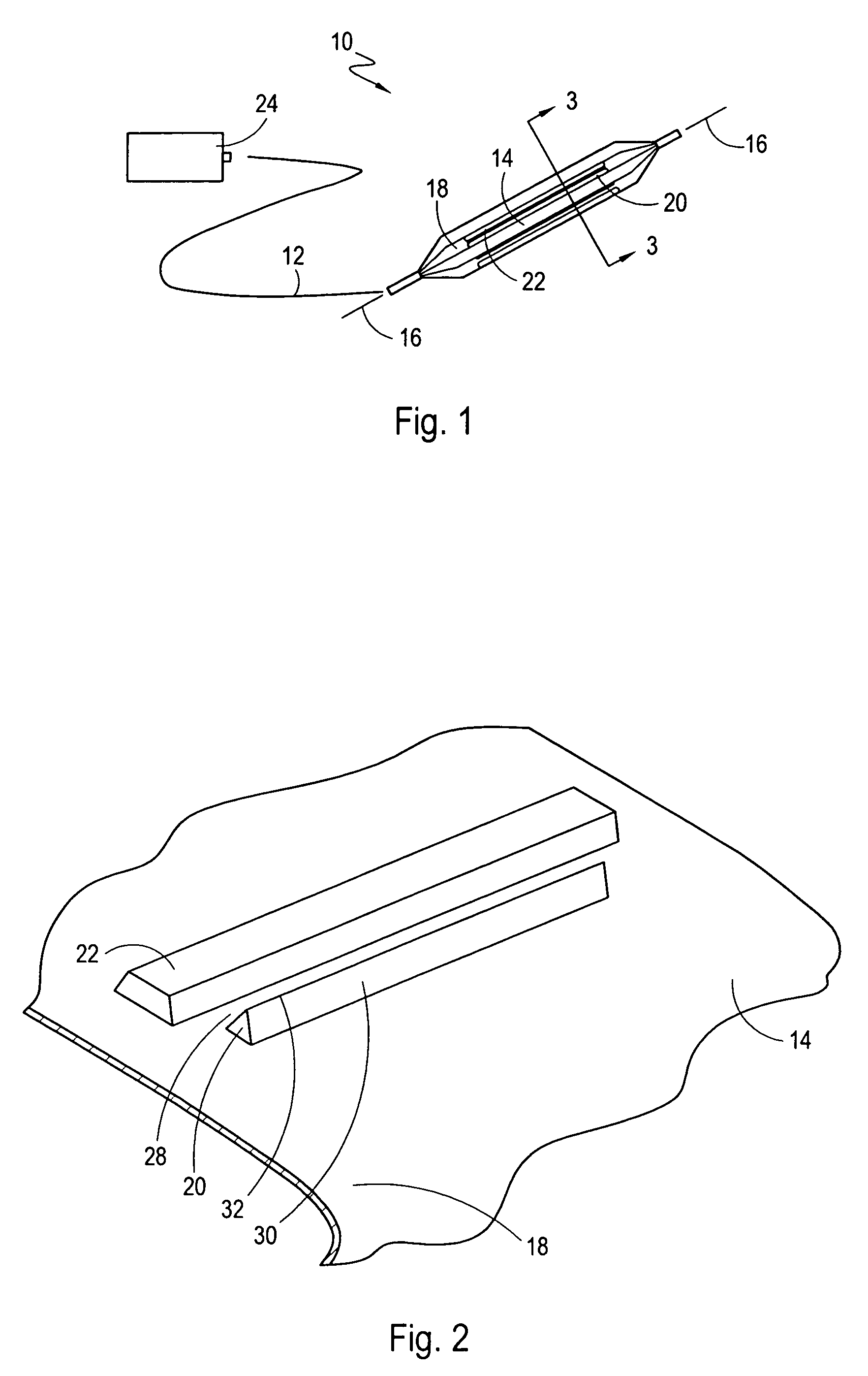 Microsurgical balloon with protective reinforcement
