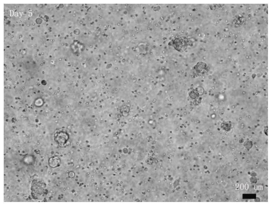 Tumor sample pretreatment method