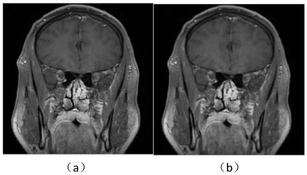 Method for establishing intracranial angiography enhanced three-dimensional stenosis analysis model