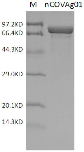 Detection kit of IgM/IgG antibodies of novel coronavirus (SARS-CoV-2)