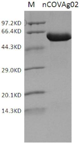 Detection kit of IgM/IgG antibodies of novel coronavirus (SARS-CoV-2)
