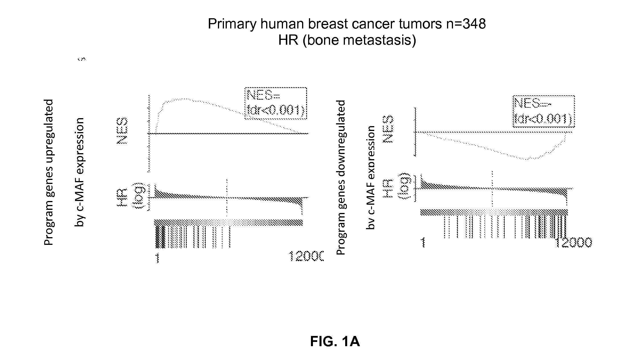 Method for the diagnosis, prognosis, and tratment of cancer metastasis
