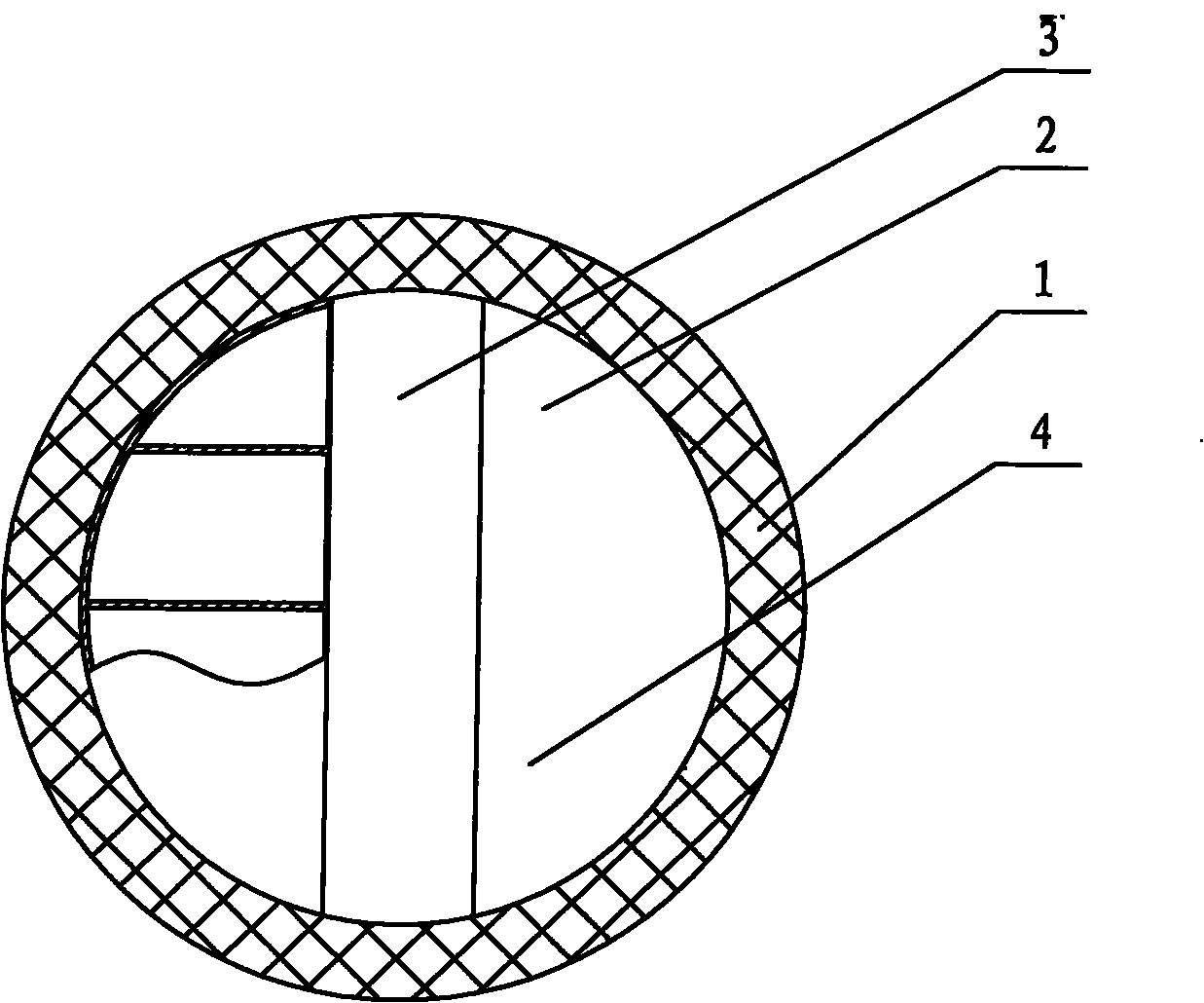 Anti-reflux support tube of ureter