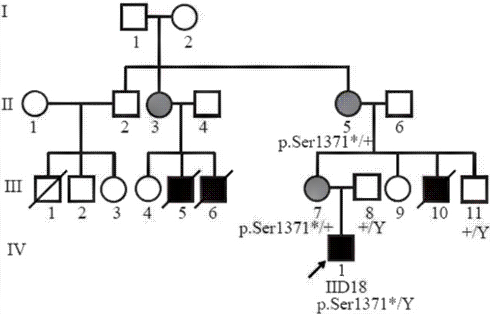 Mutational COL4A5 gene and application thereof