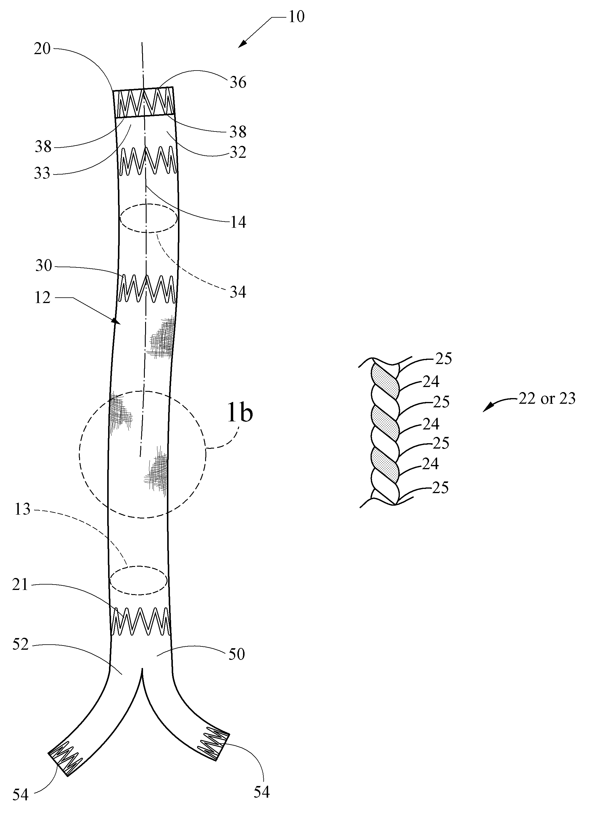 Implantable graft device having treated yarn and method for making same
