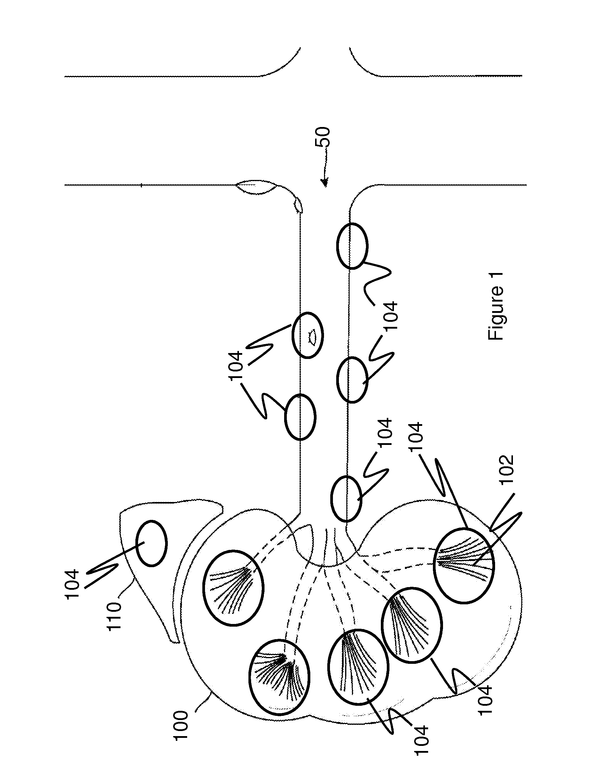 Method for imporoving kidney function with extracorporeal shockwaves