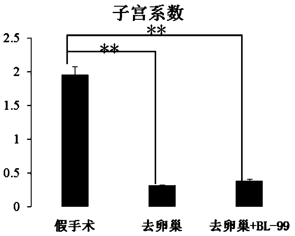 Bifidobacterium lactis-containing fermented dairy product and application thereof