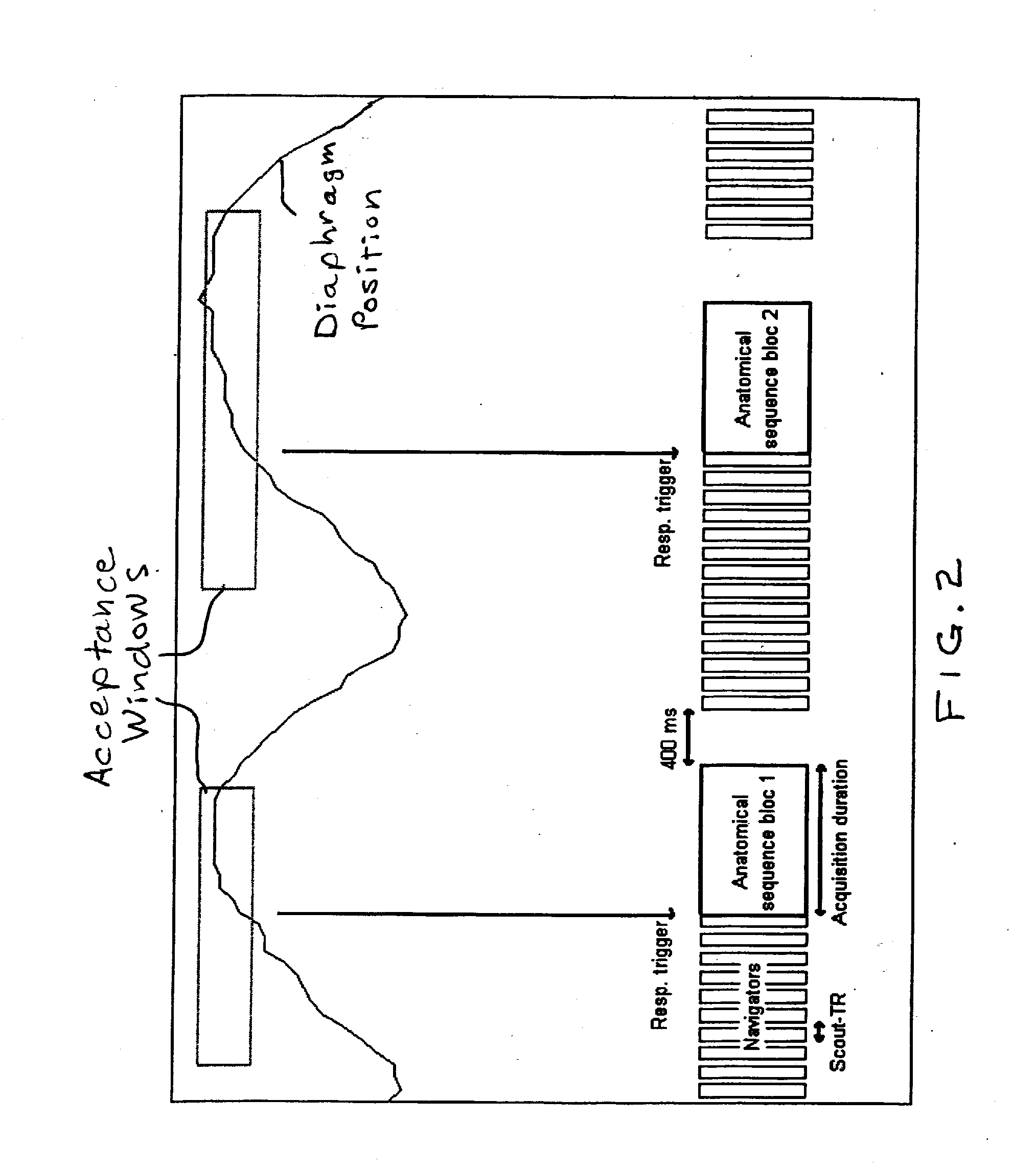 Magnetic resonance lmethod and apparatus with gated shimming of the basic magnetic field