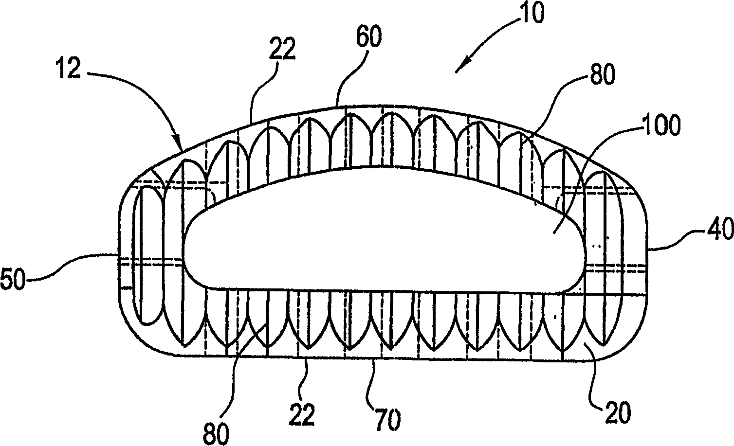 Spinal fusion implant