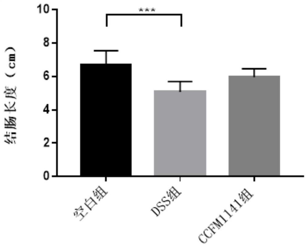 Lactobacillus rumen for relieving colitis and application of lactobacillus rumen