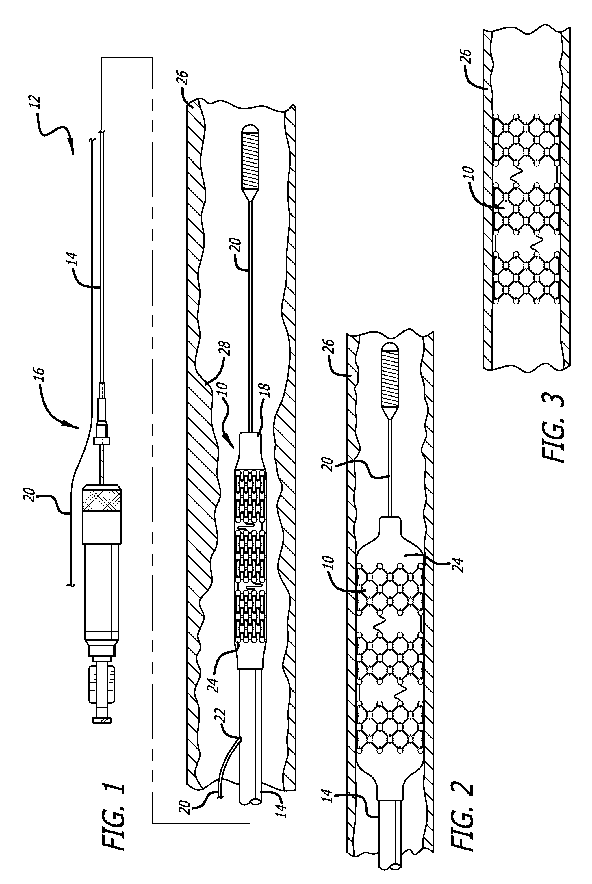 Endoprostheses with strut pattern having multiple stress relievers