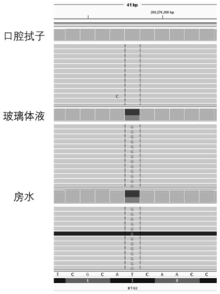 Extraction method and kit of aqueous humor cfDNA and application of aqueous humor cfDNA in PVRL clinical auxiliary examination