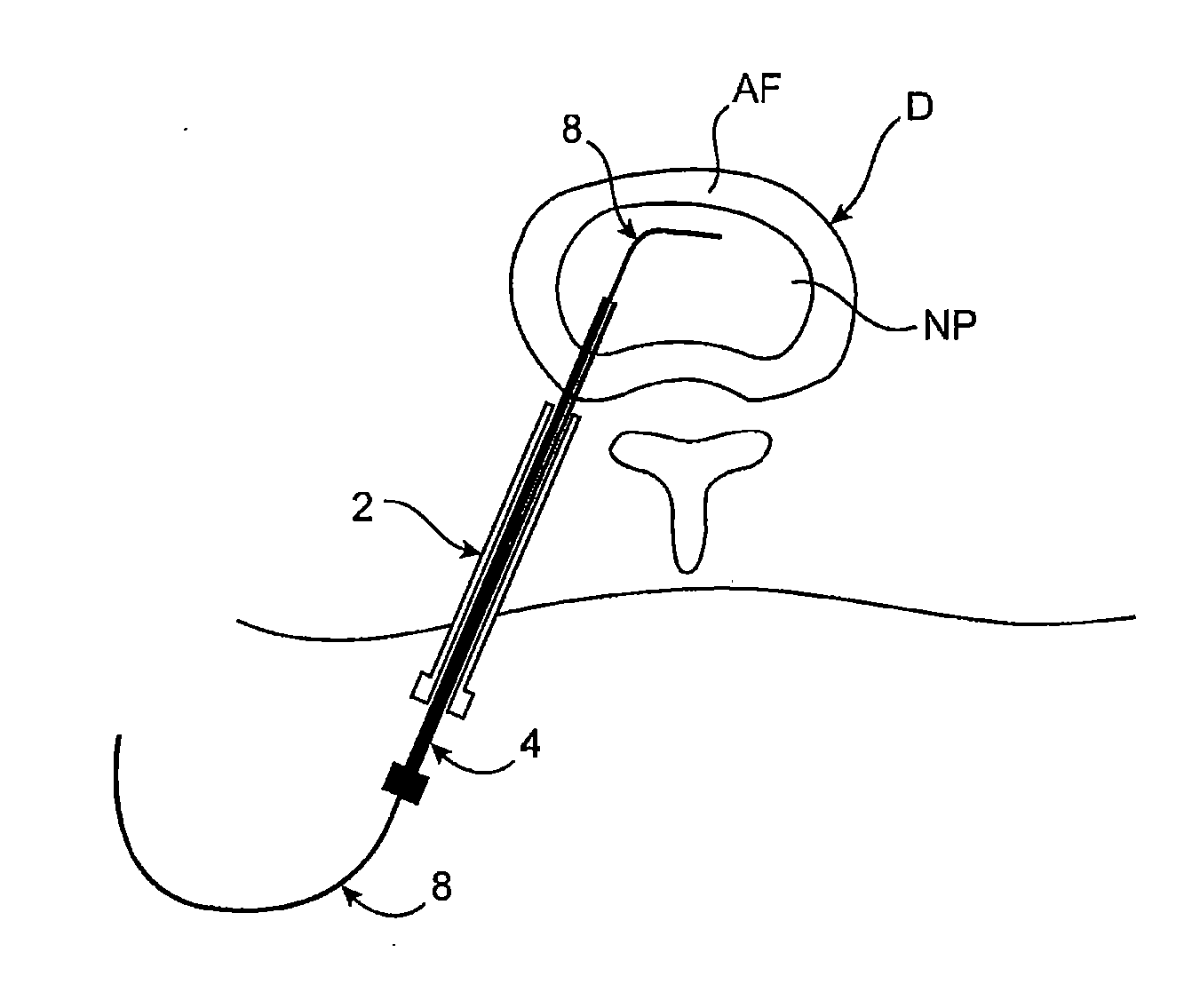 Spinal diagnostic methods and apparatus