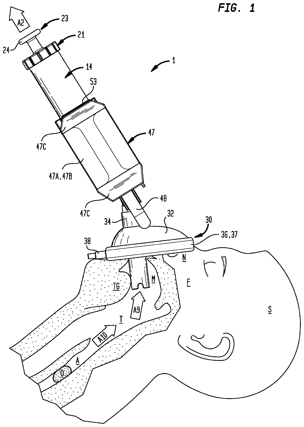Airway Assist Device