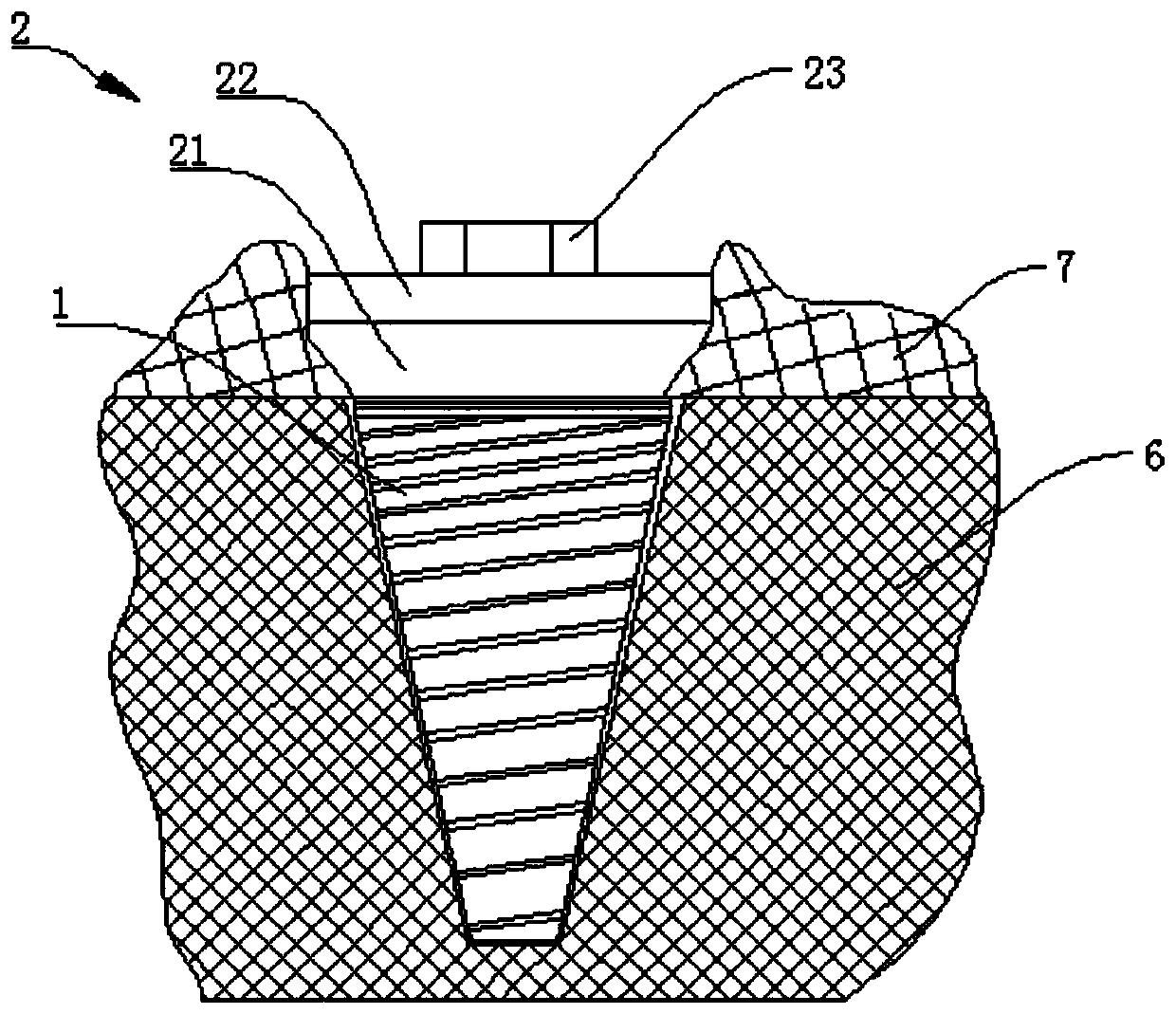 Upper part repairing device and repairing method for two-section type transplanting