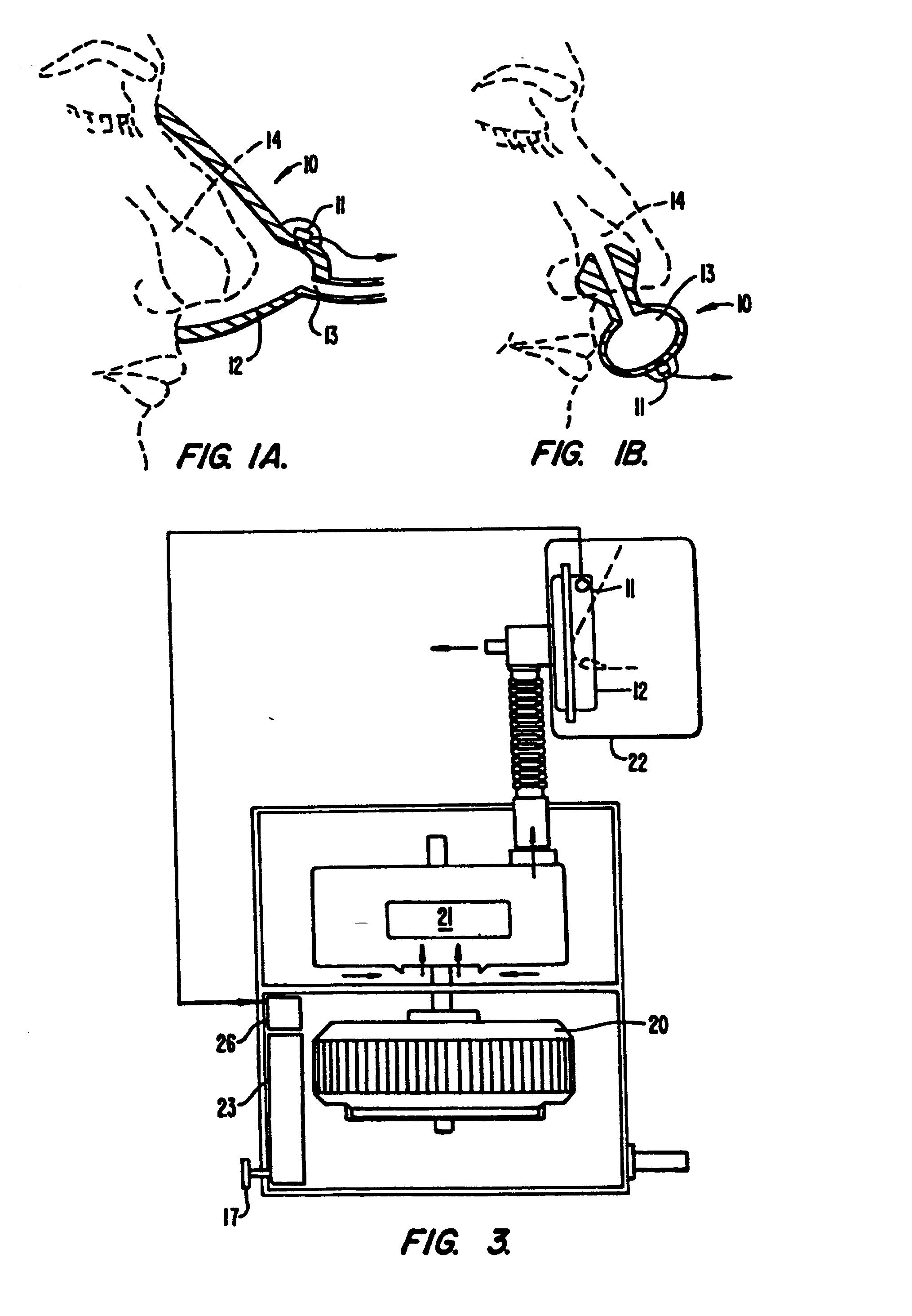 Method and apparatus useful in the diagnosis of obstructive sleep apnea of a patient