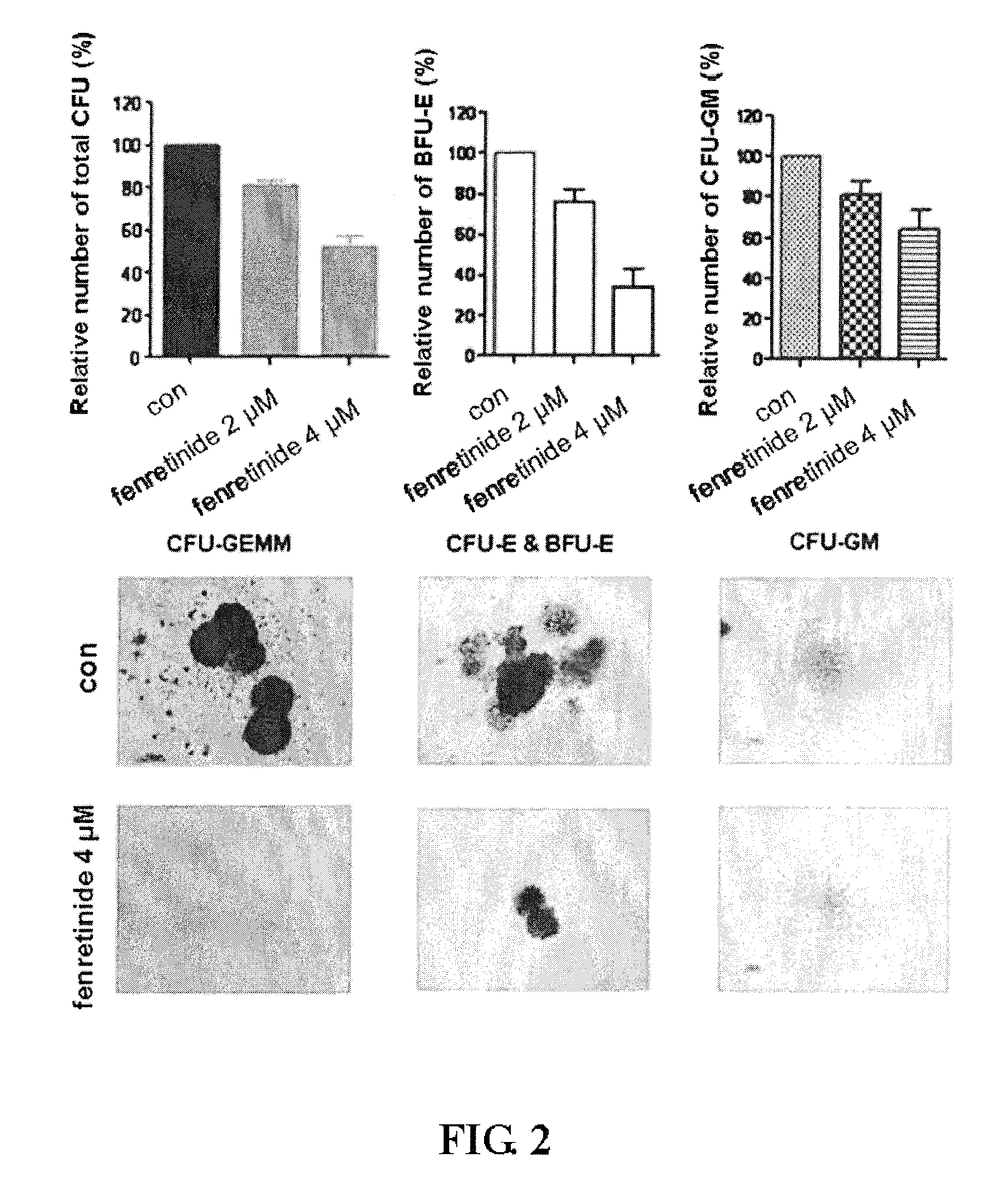 Use of fenretinide or bioactive derivatives thereof and pharmaceutical compositions comprising the same