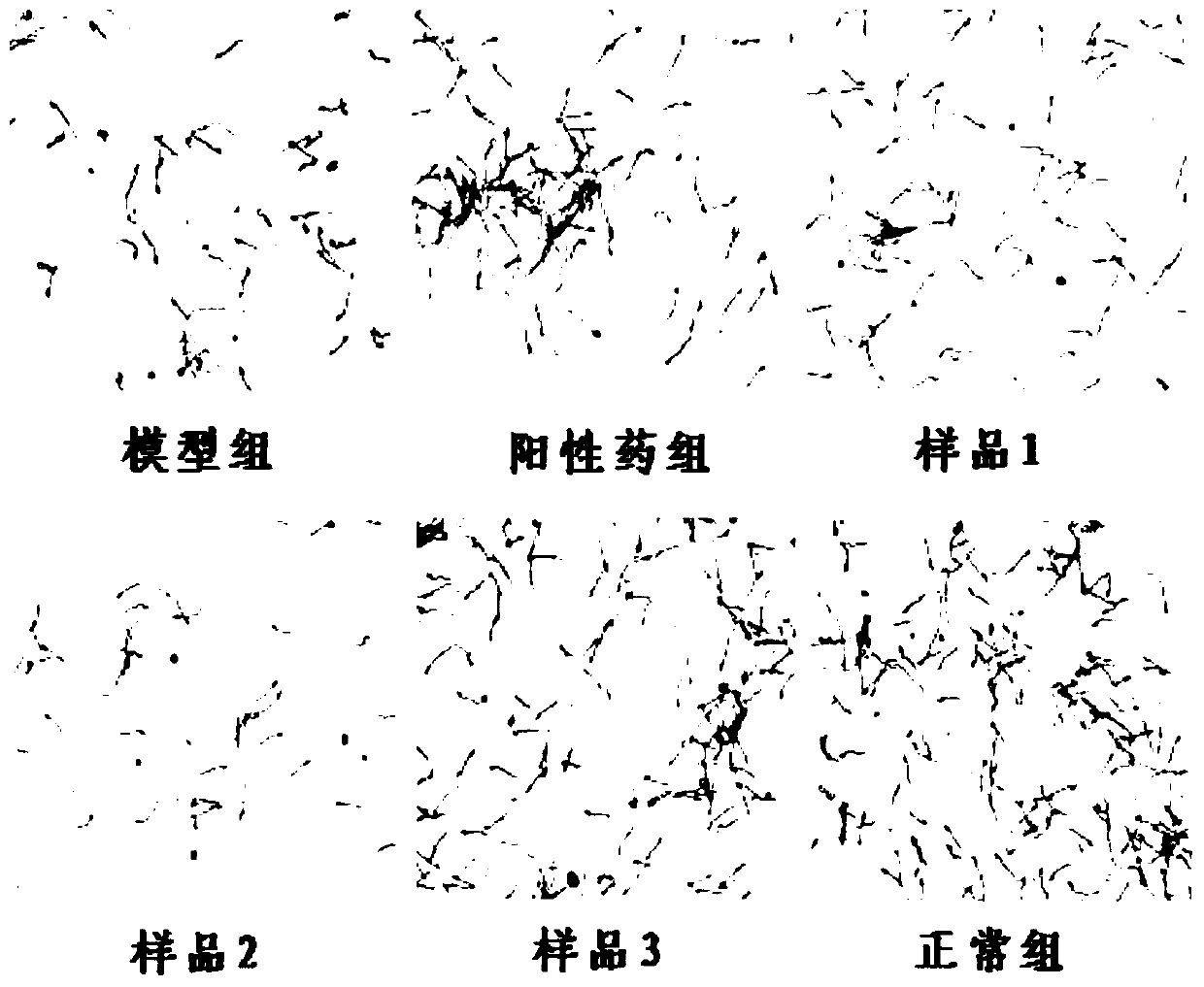 Ginseng glycoprotein as well as preparation method and application thereof