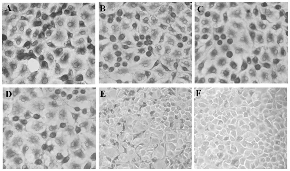 IPMA antibody detection method of Lawsonia intracellularis