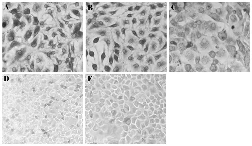 IPMA antibody detection method of Lawsonia intracellularis