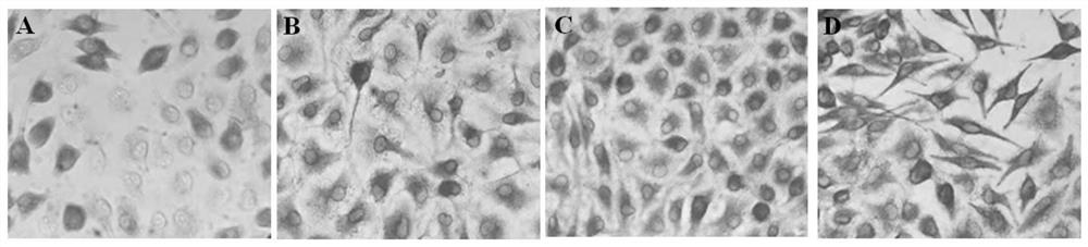 IPMA antibody detection method of Lawsonia intracellularis