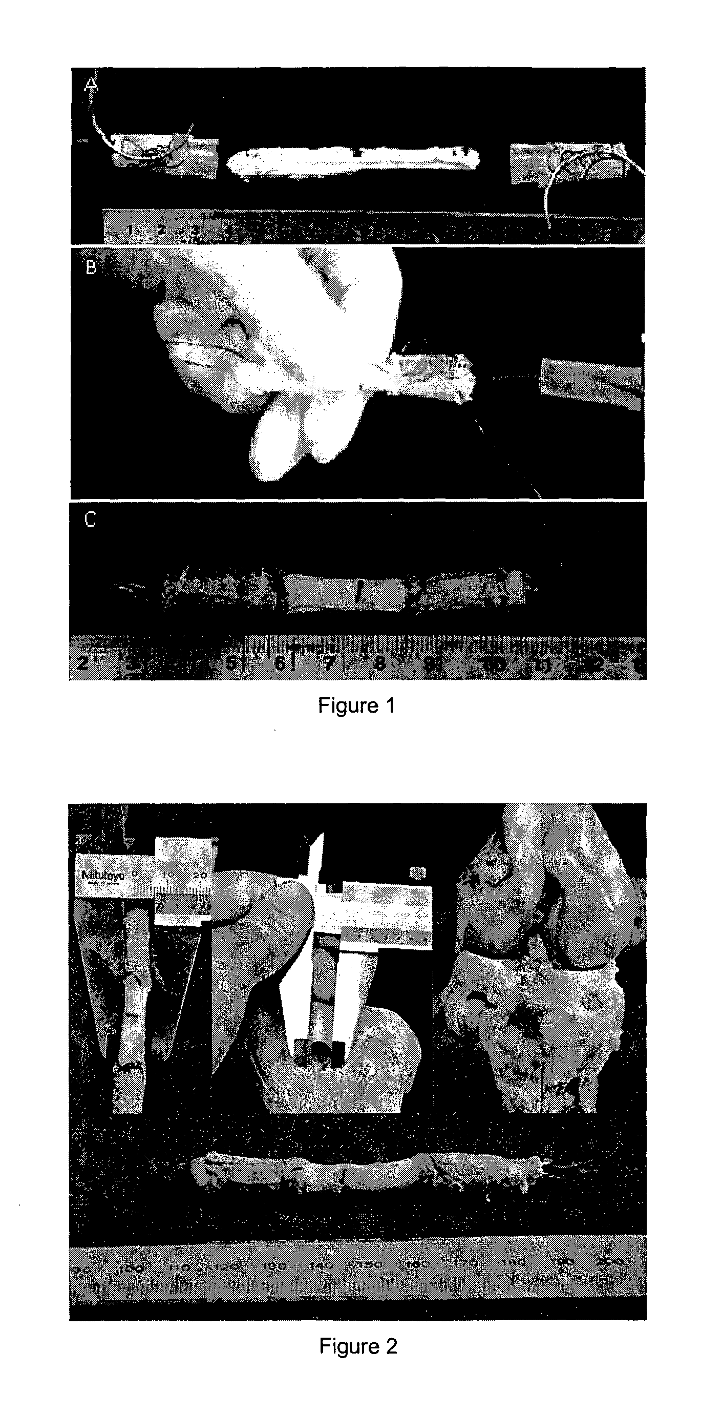 Tissue interface augmentation device for ligament/tendon reconstruction