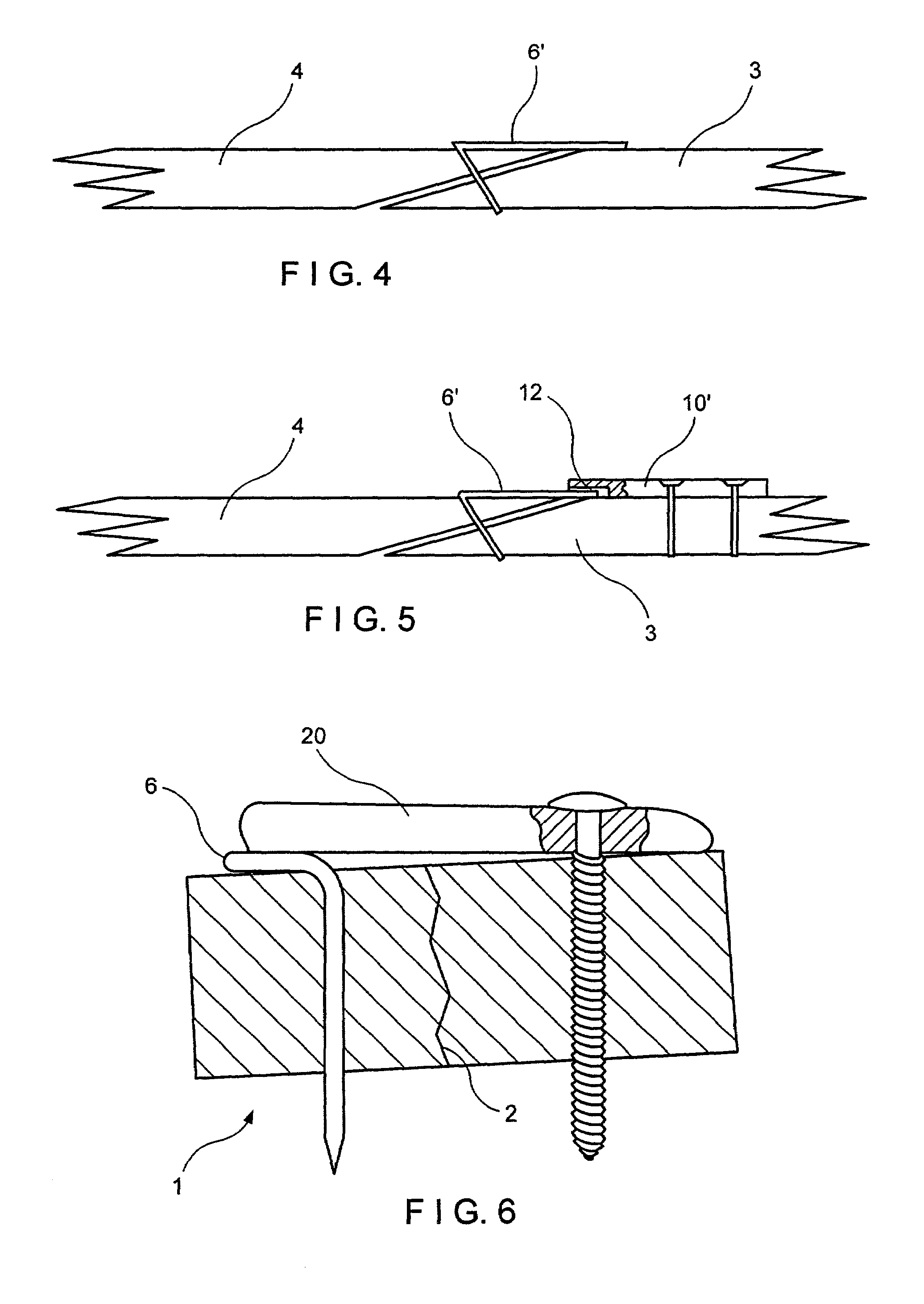 Fracture fixation device in which a fixation pin is axially restrained