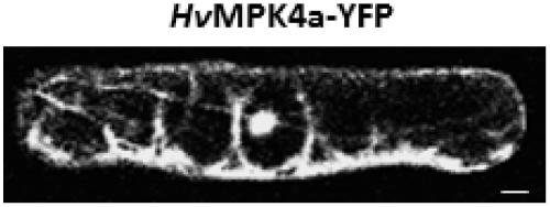 Protein kinase hvmpk4a related to barley powdery mildew resistance and its coding gene and application