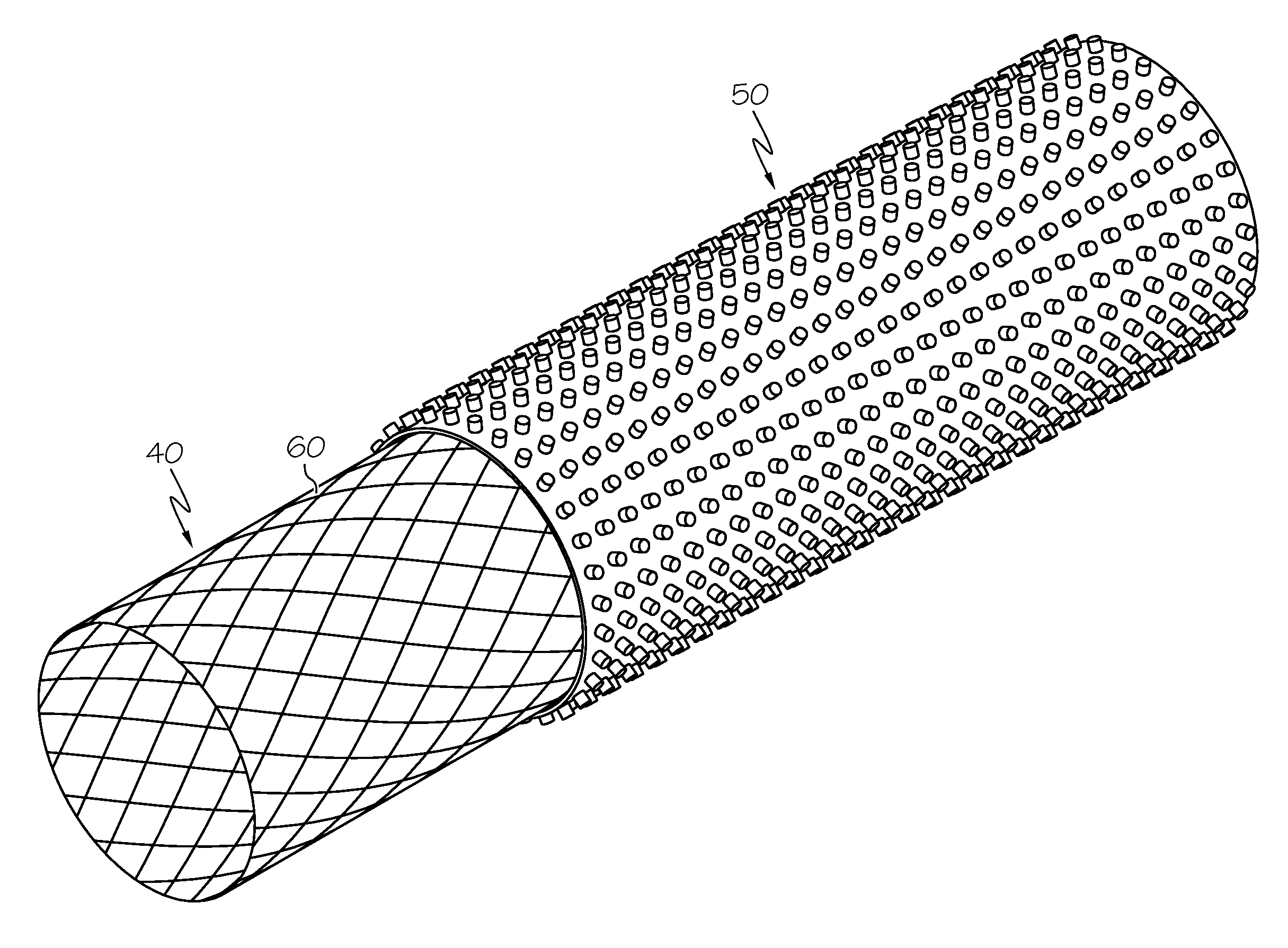 Anti-migration micropatterned stent coating