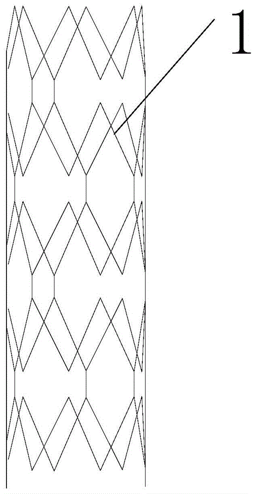 Degradable magnesium alloy membranous stent and membranous stent system