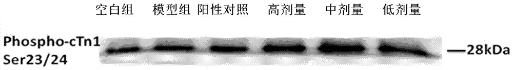 Medicine composition, and preparation method, preparation and application thereof