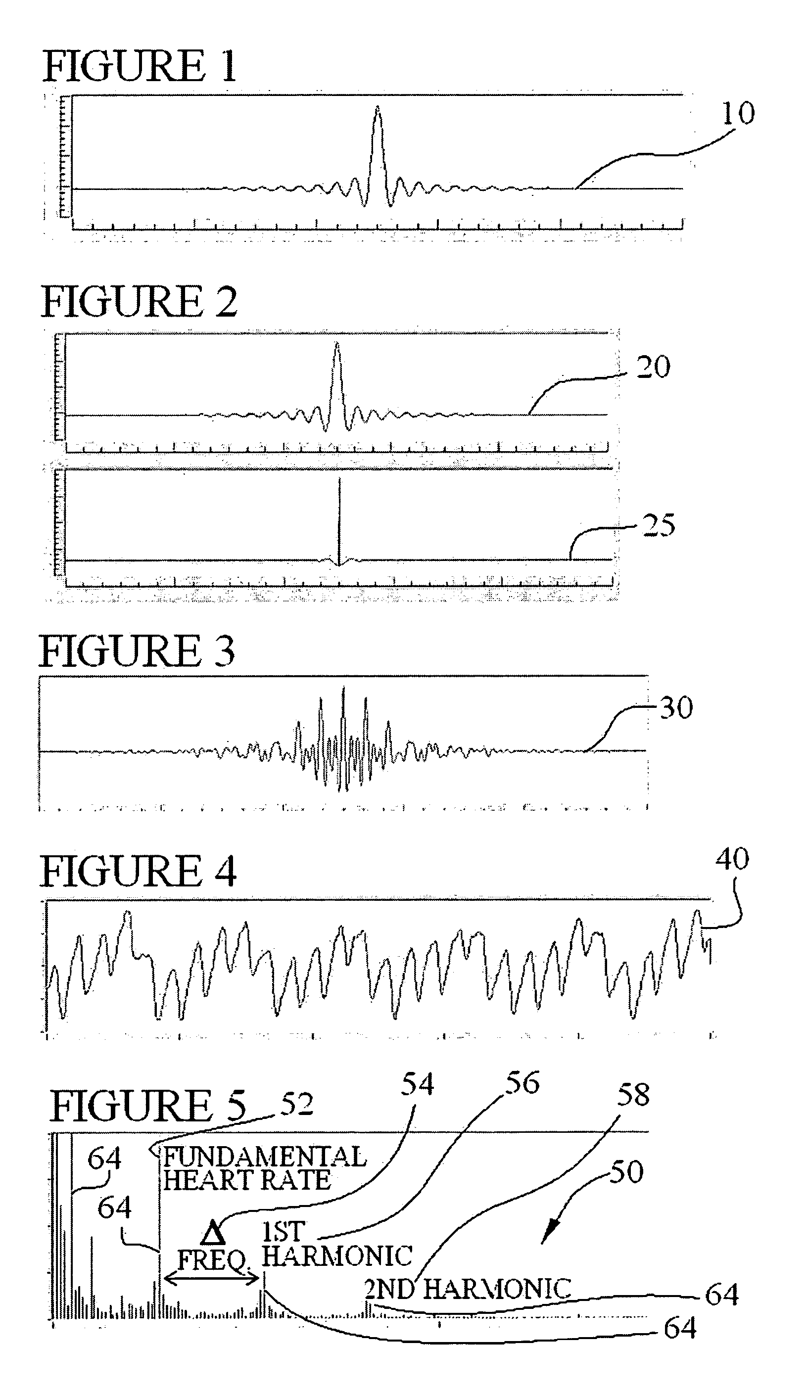 Techniques for accurately deriving physiologic parameters of a subject from photoplethysmographic measurements