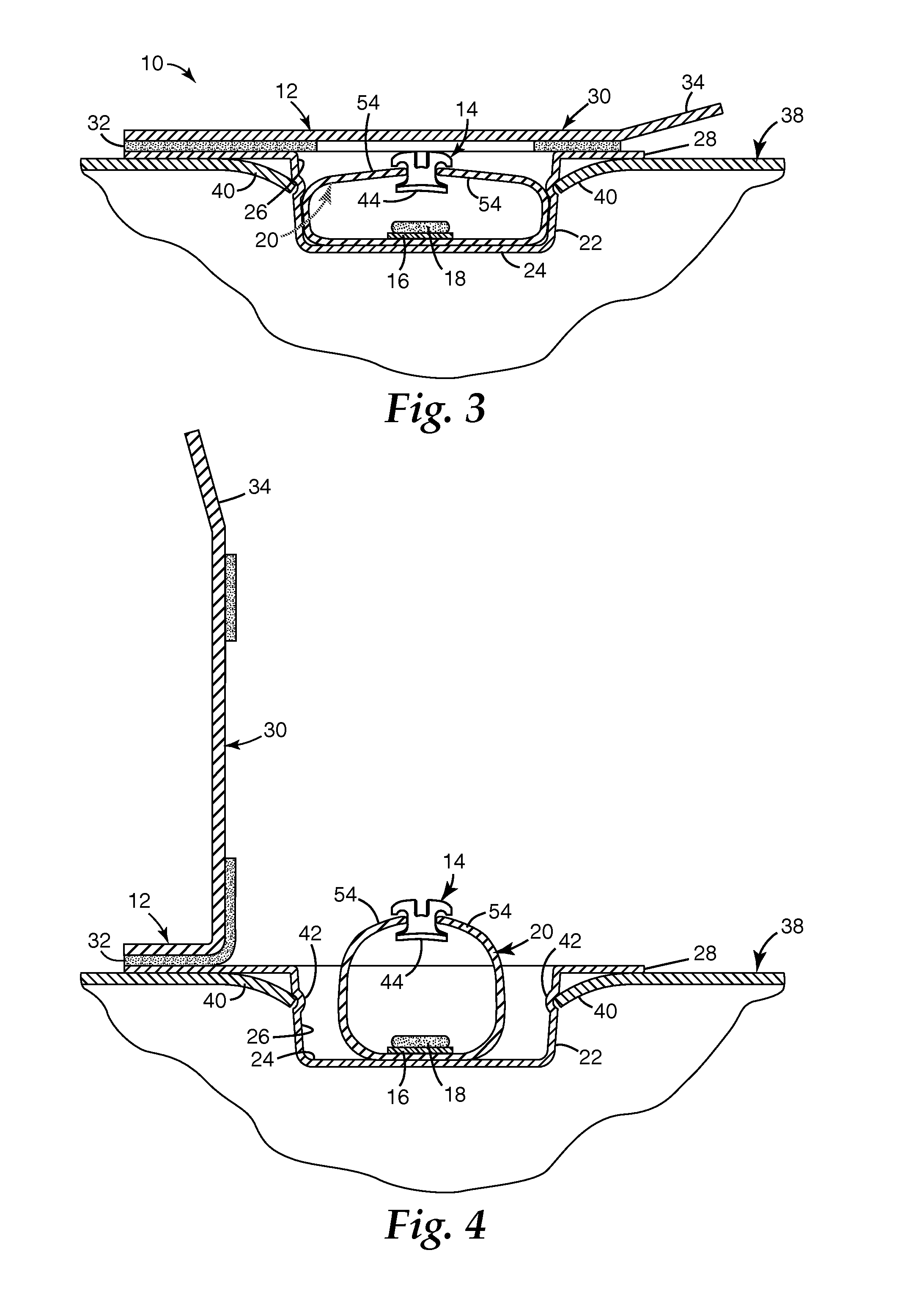 Packaged orthodontic appliance with user-applied adhesive