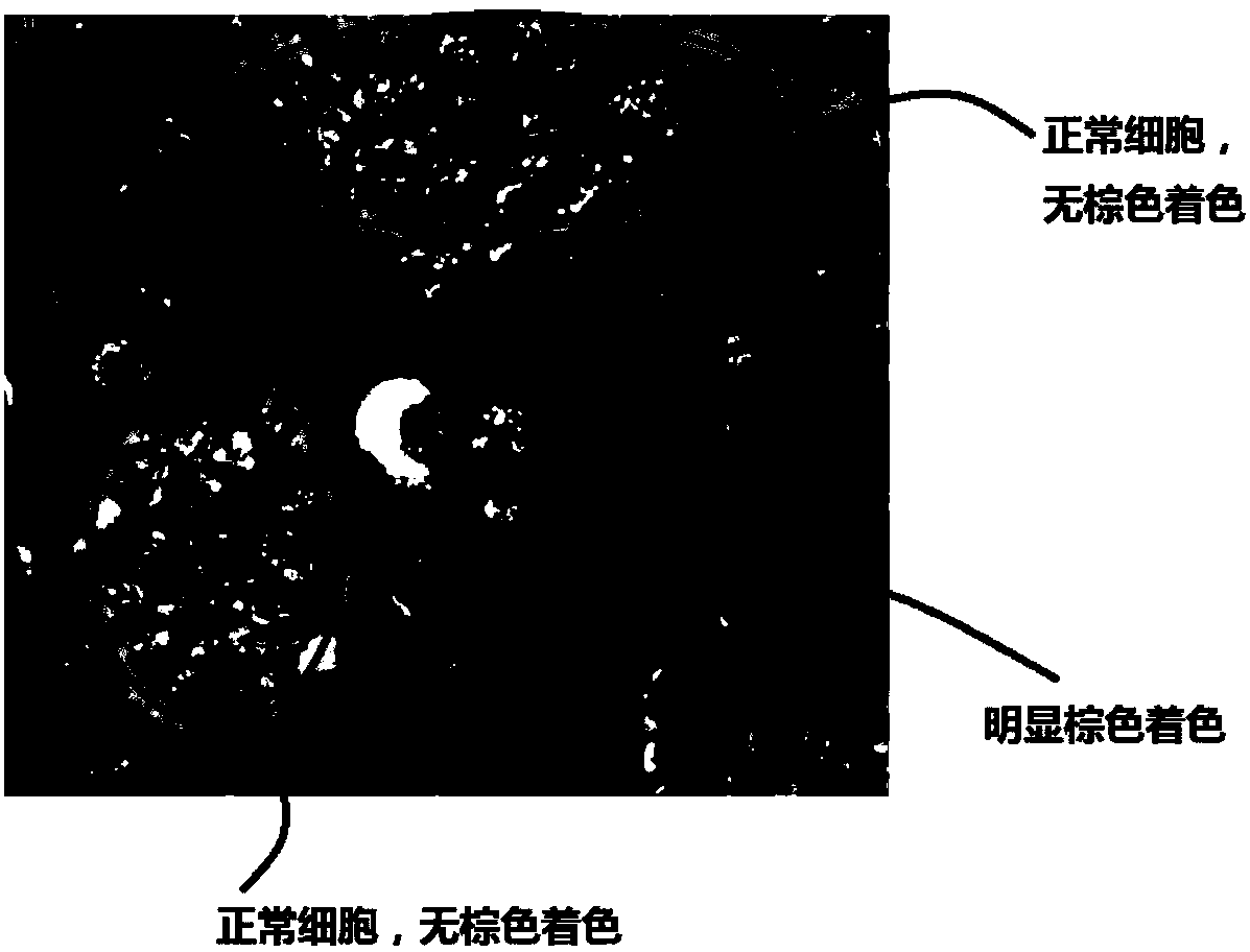 High-stability PD-L1 antibody reagent and application thereof