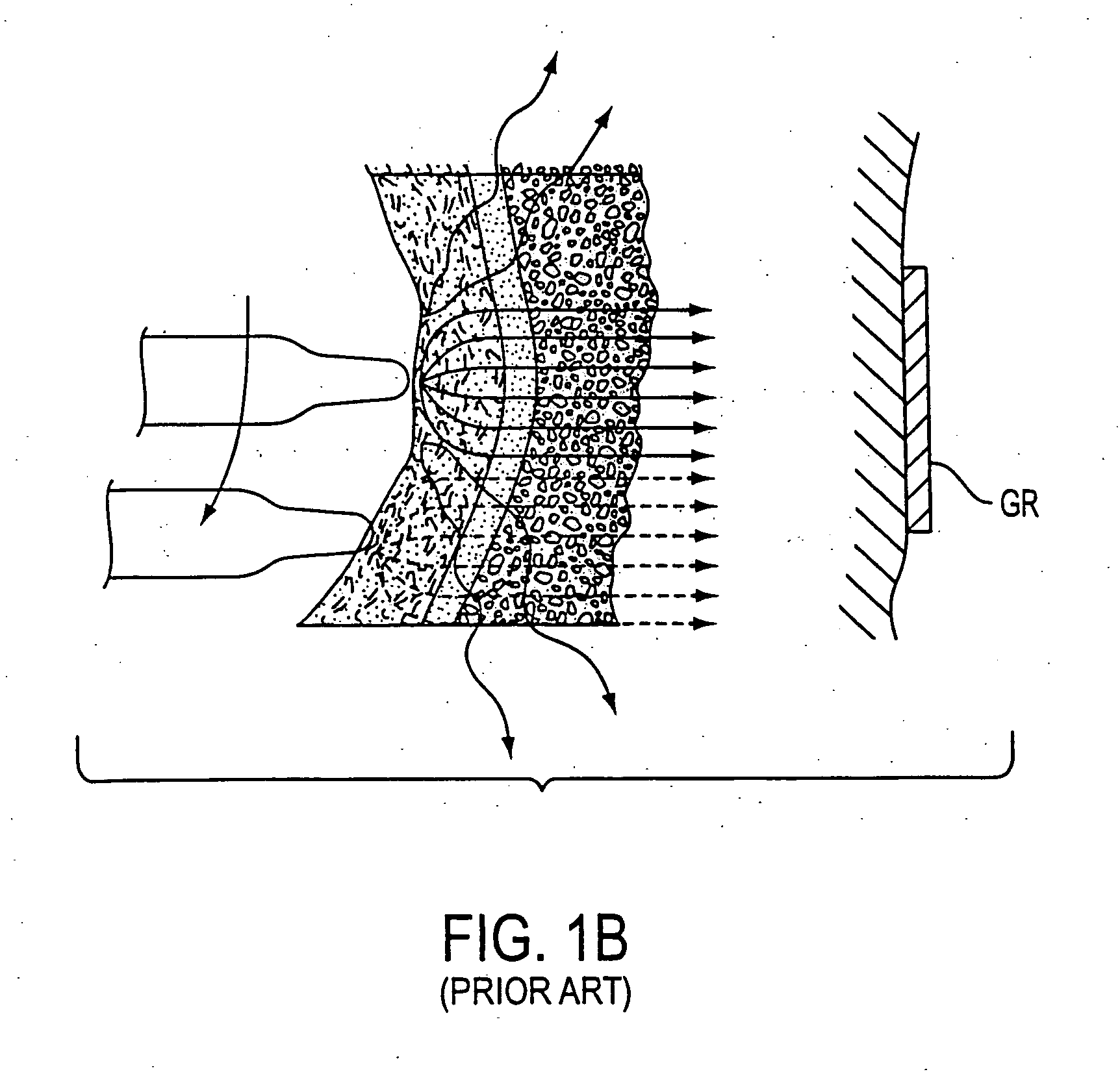 RF electrode array for low-rate collagen shrinkage in capsular shift procedures and methods of use