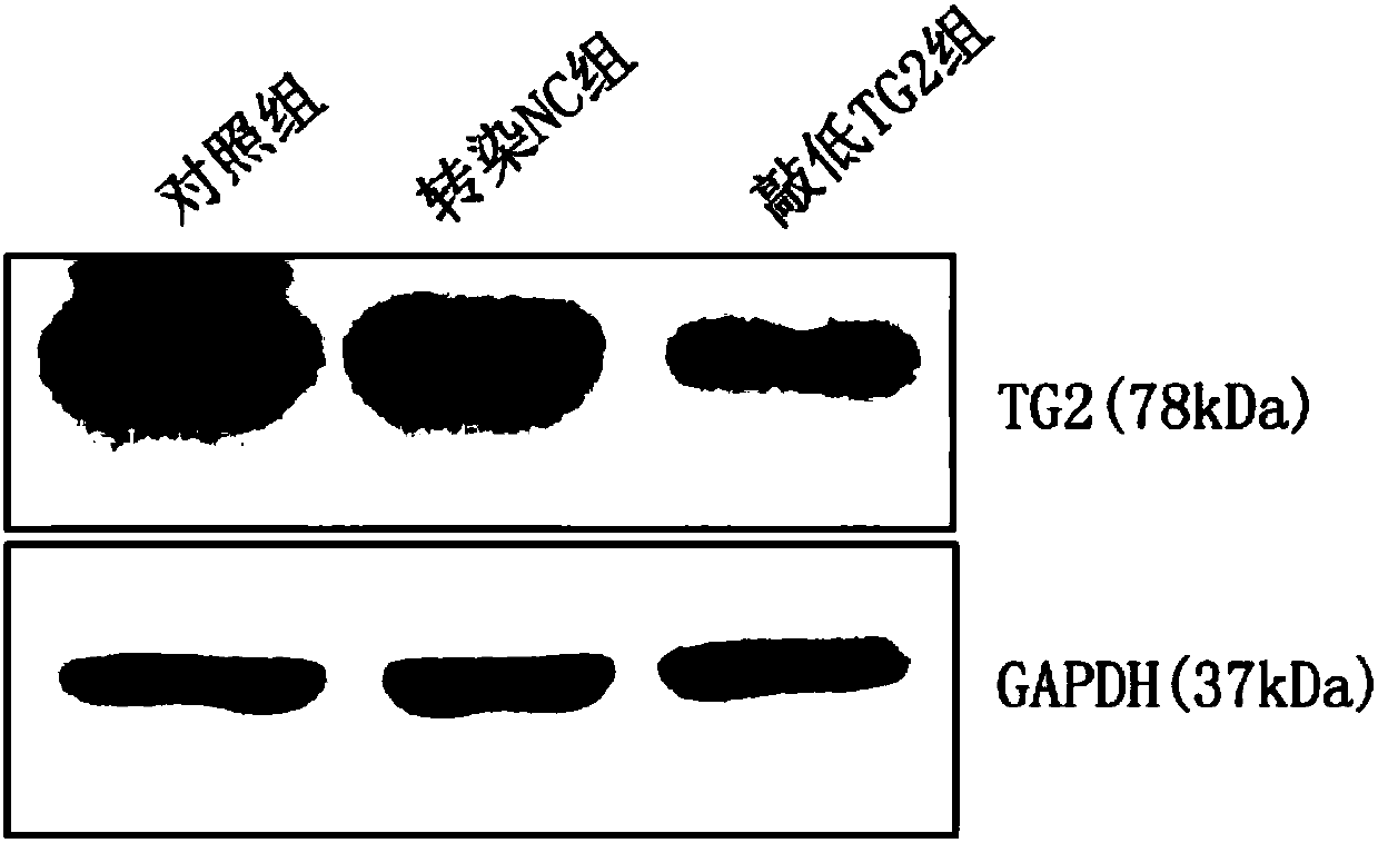 Application of reagent for restraining or reducing TG2 gene expression in preparation of tumor radiotherapy sensitivity-enhancing medicine