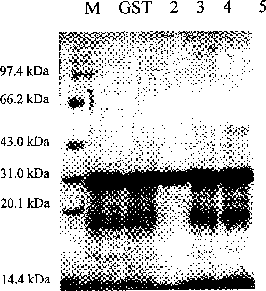 Nuclear factor-K B P65 subunit antagonistic peptide and its use