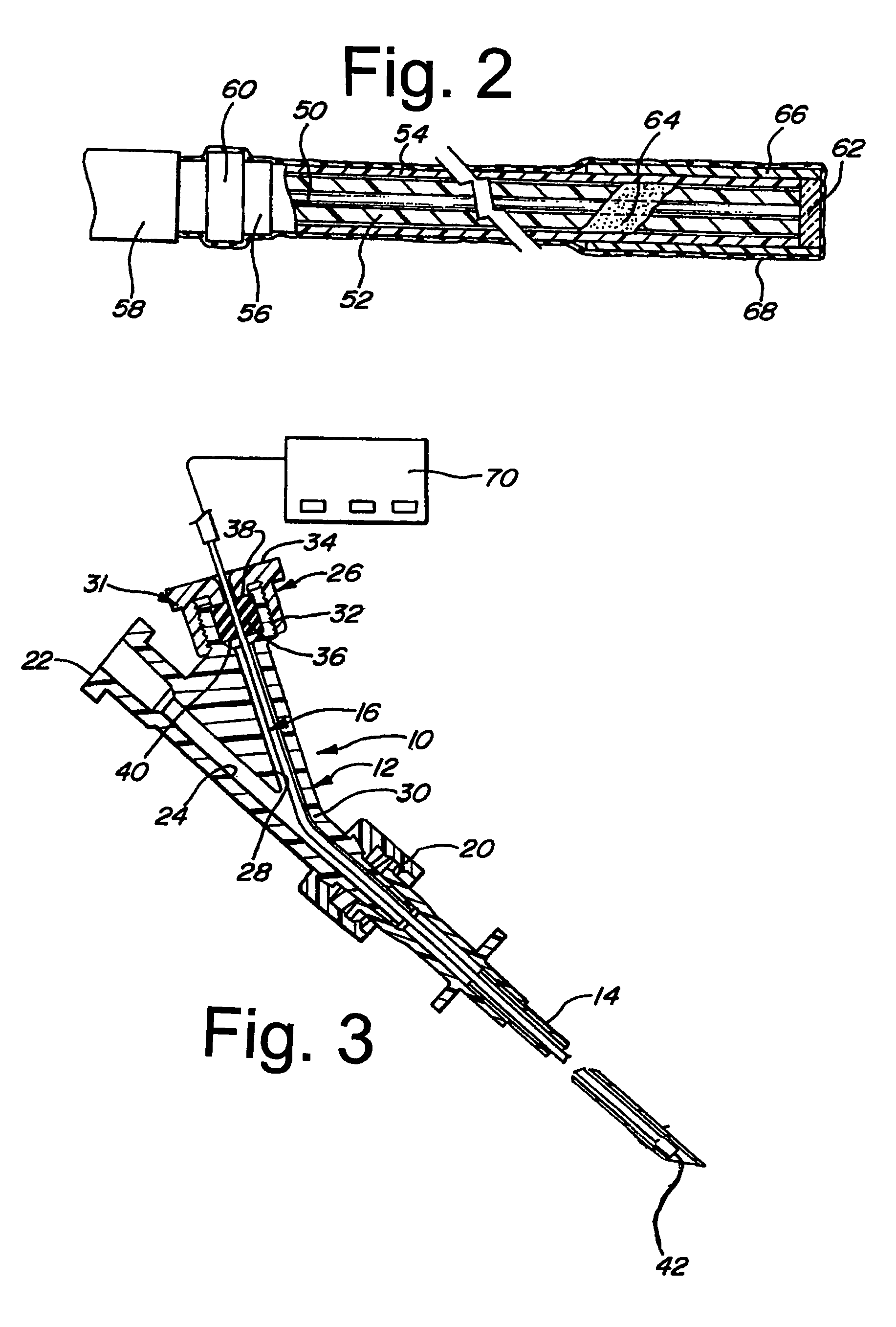 Regional anesthetic method and apparatus