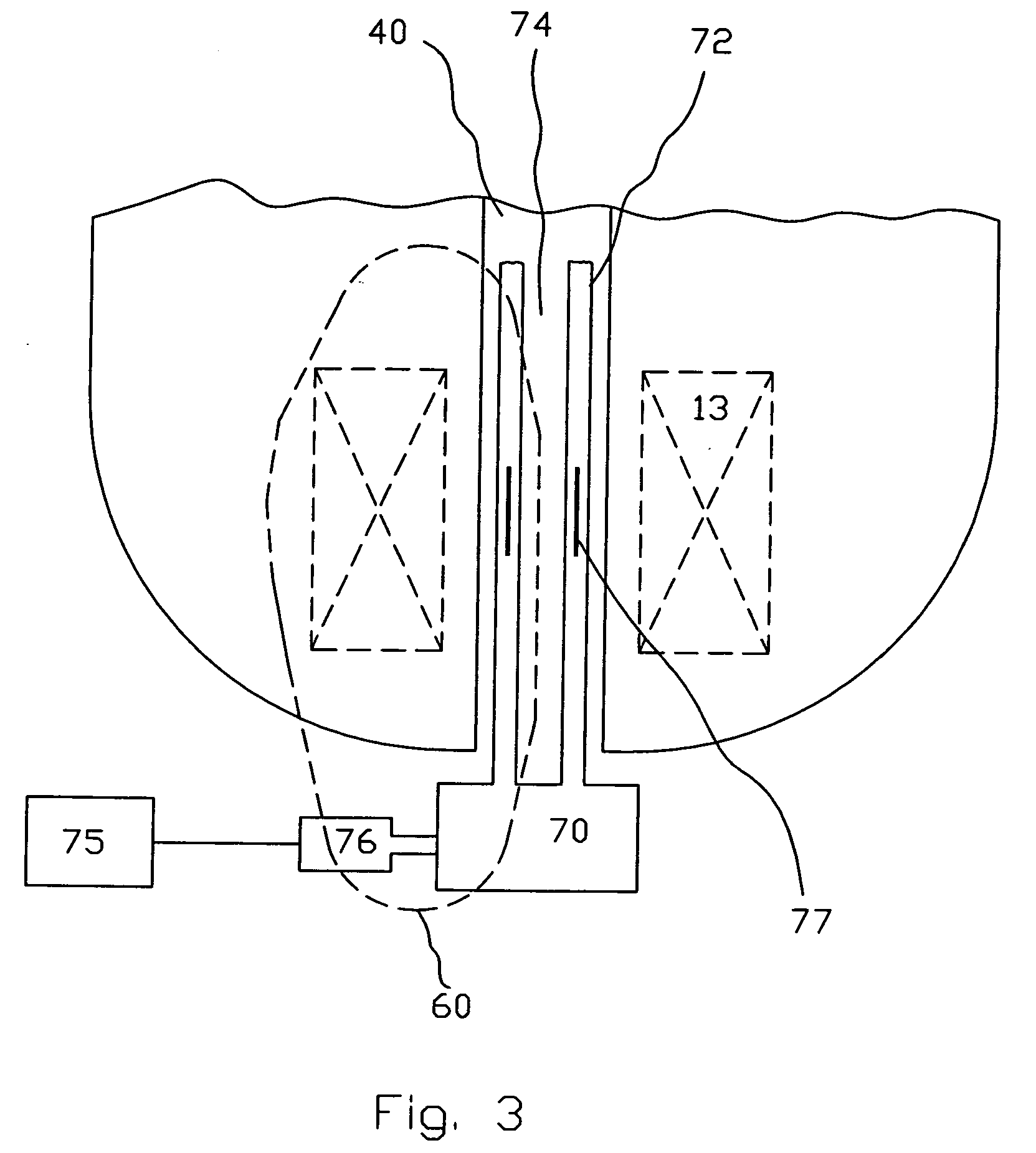 Ion pump for cryogenic magnet apparatus