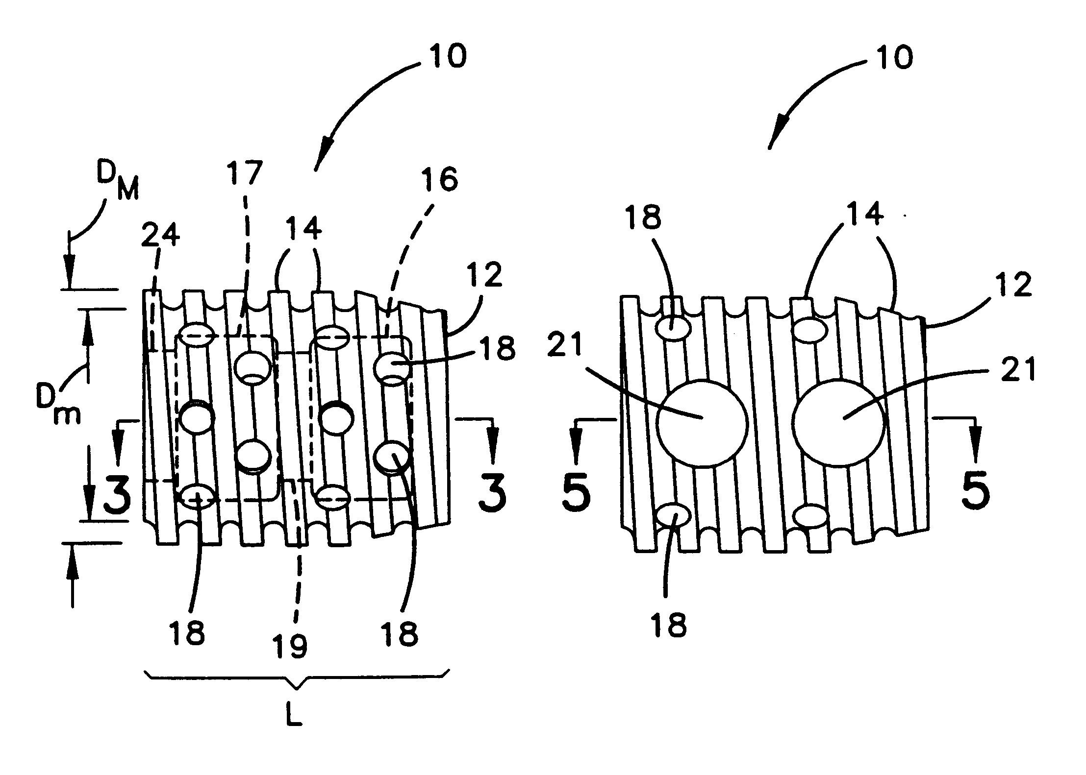 Apparatus and method for spinal stabilization
