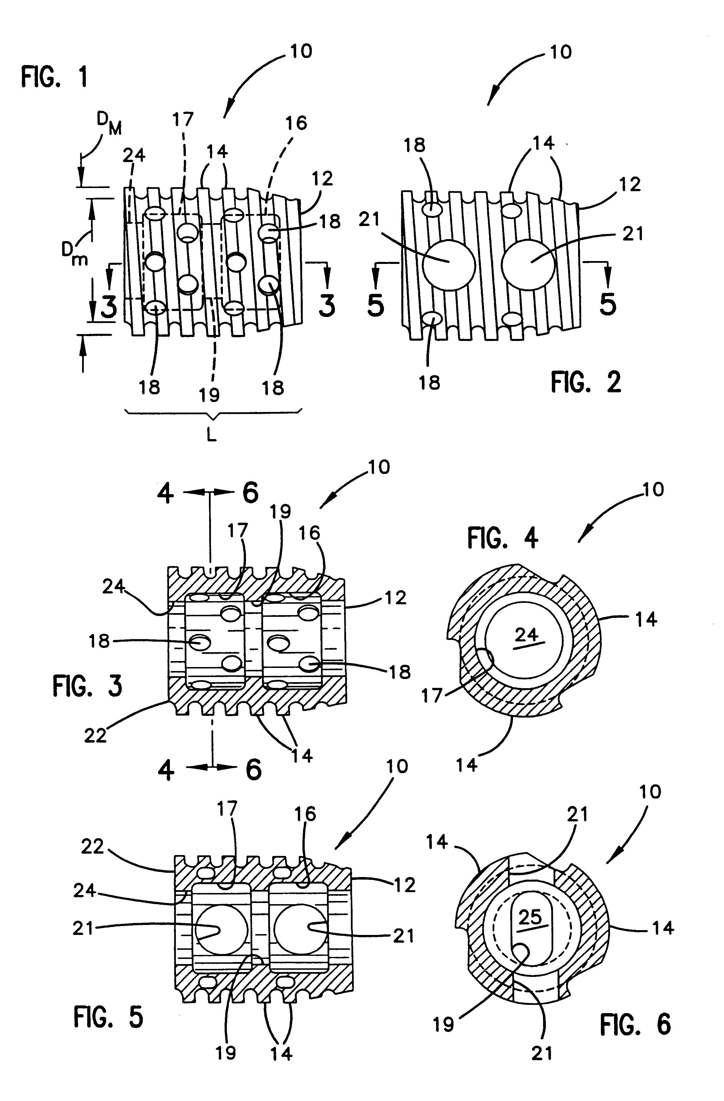 Apparatus and method for spinal stabilization