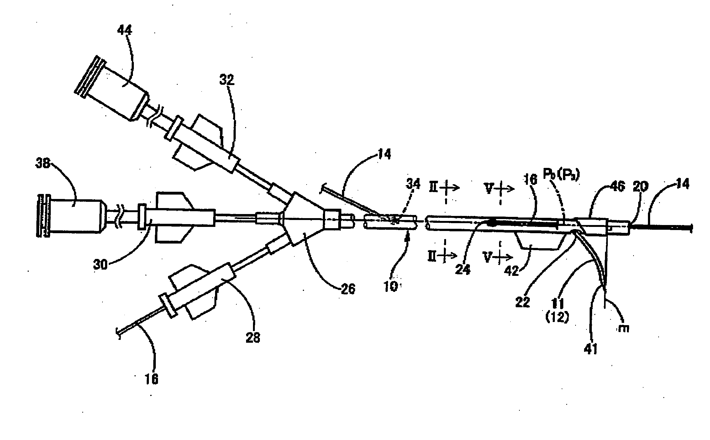 Infusion device