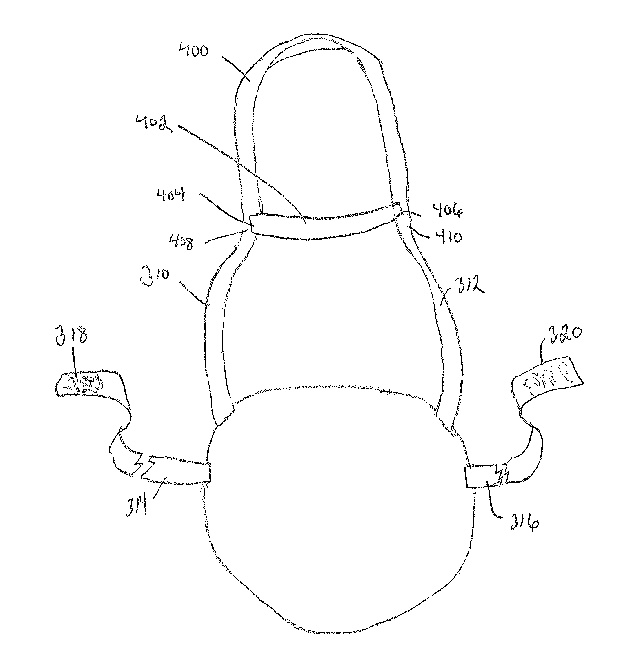 Prosthetic apparatus and method