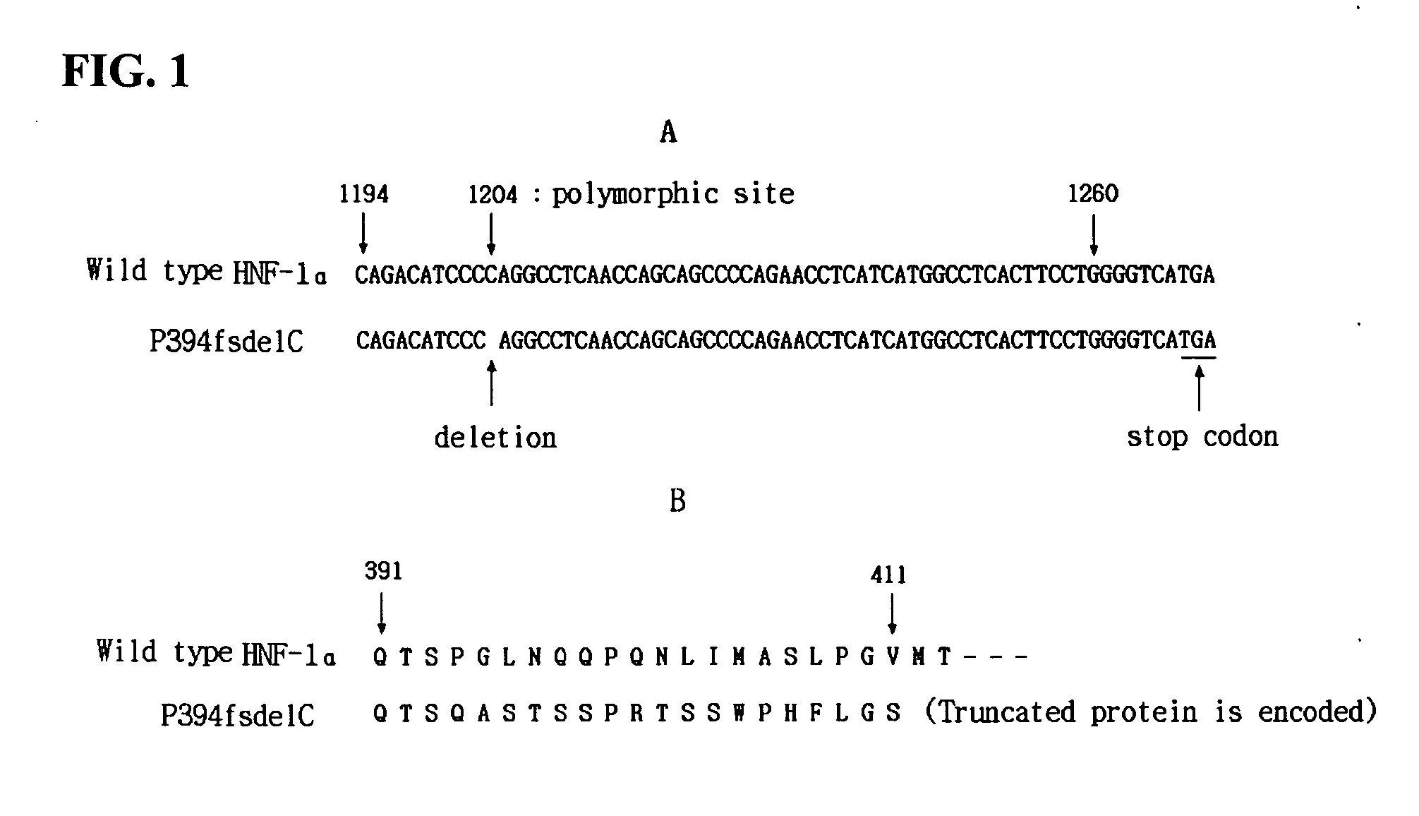 HNF-1alpha gene including novel single-nucleotide polymorphism, protein encoded by the HNF-1alpha gene, and polynucleotide, microarray, kit, and method for diagnosis of MODY3