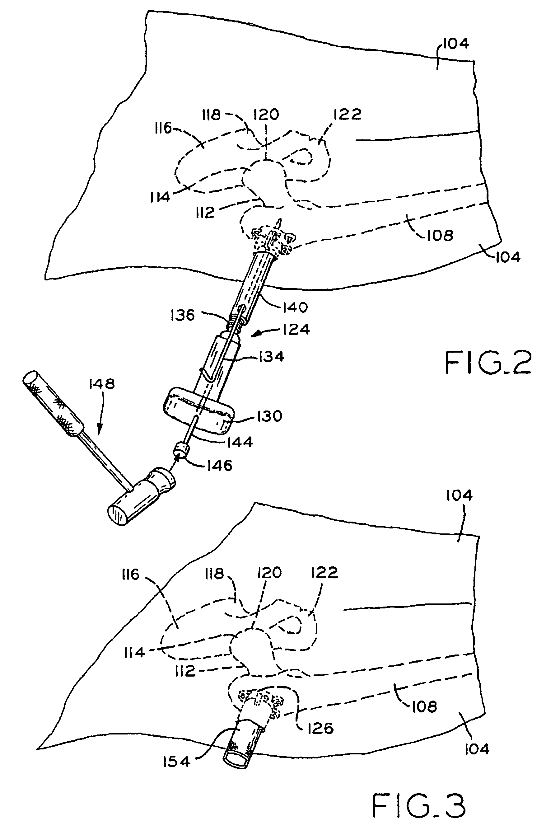 Method and apparatus for reducing femoral fractures