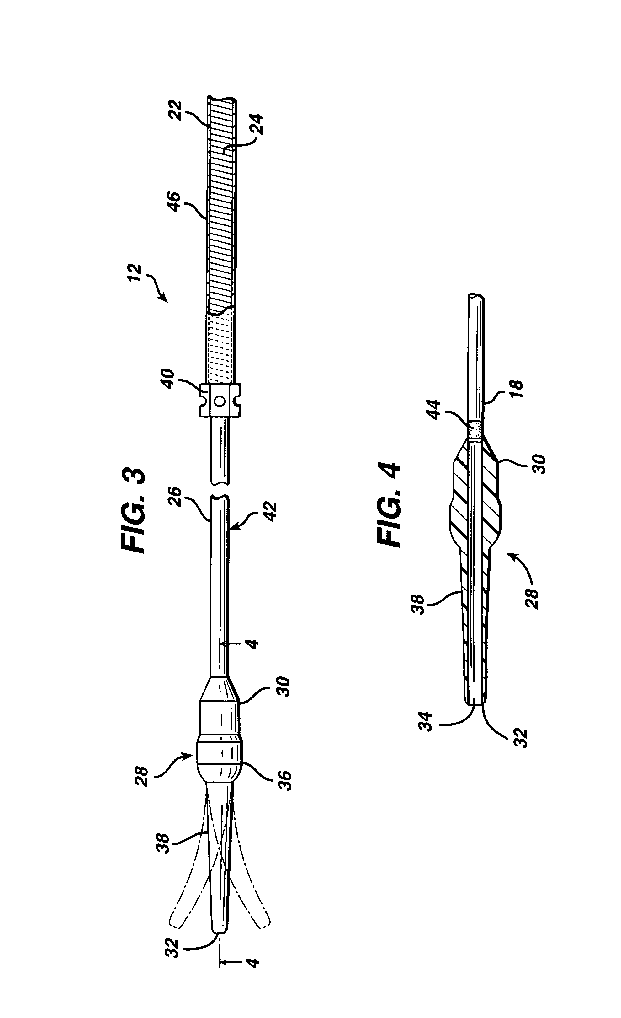 Self-expanding stent delivery system