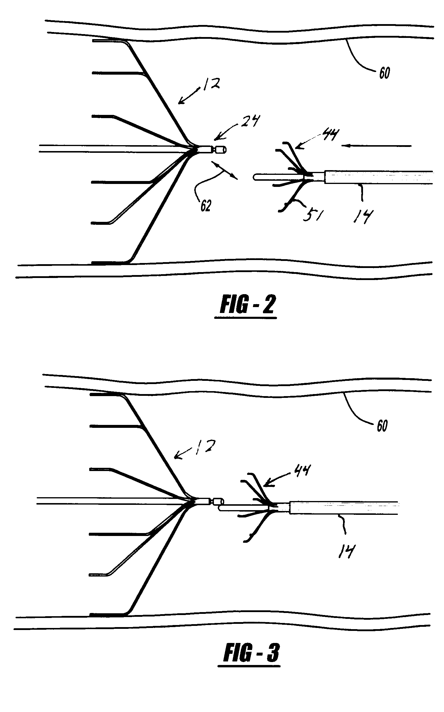 System and method for retrieval of a medical filter