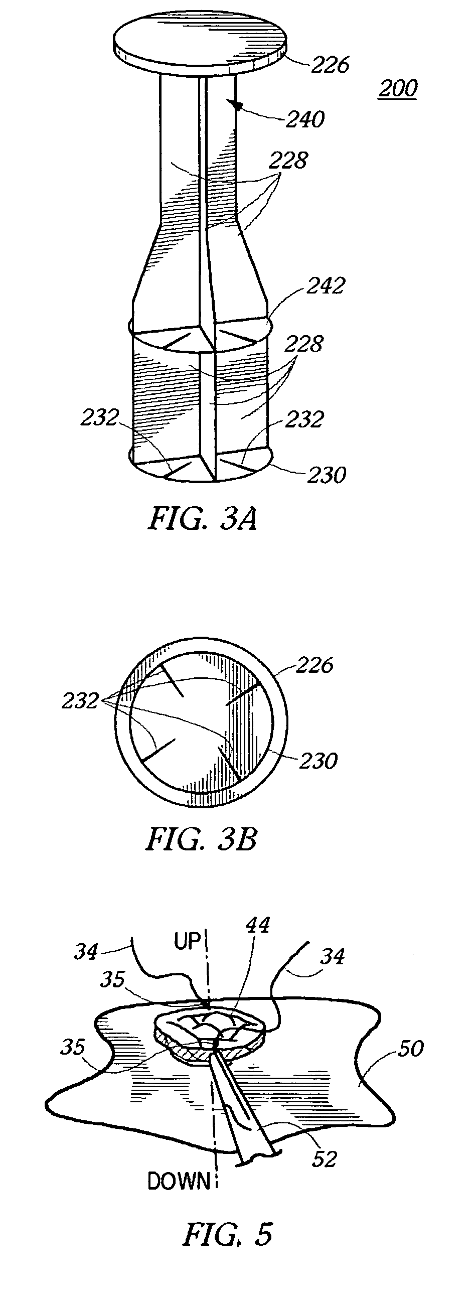 Method and device for umbilicus protection during abdominal surgery