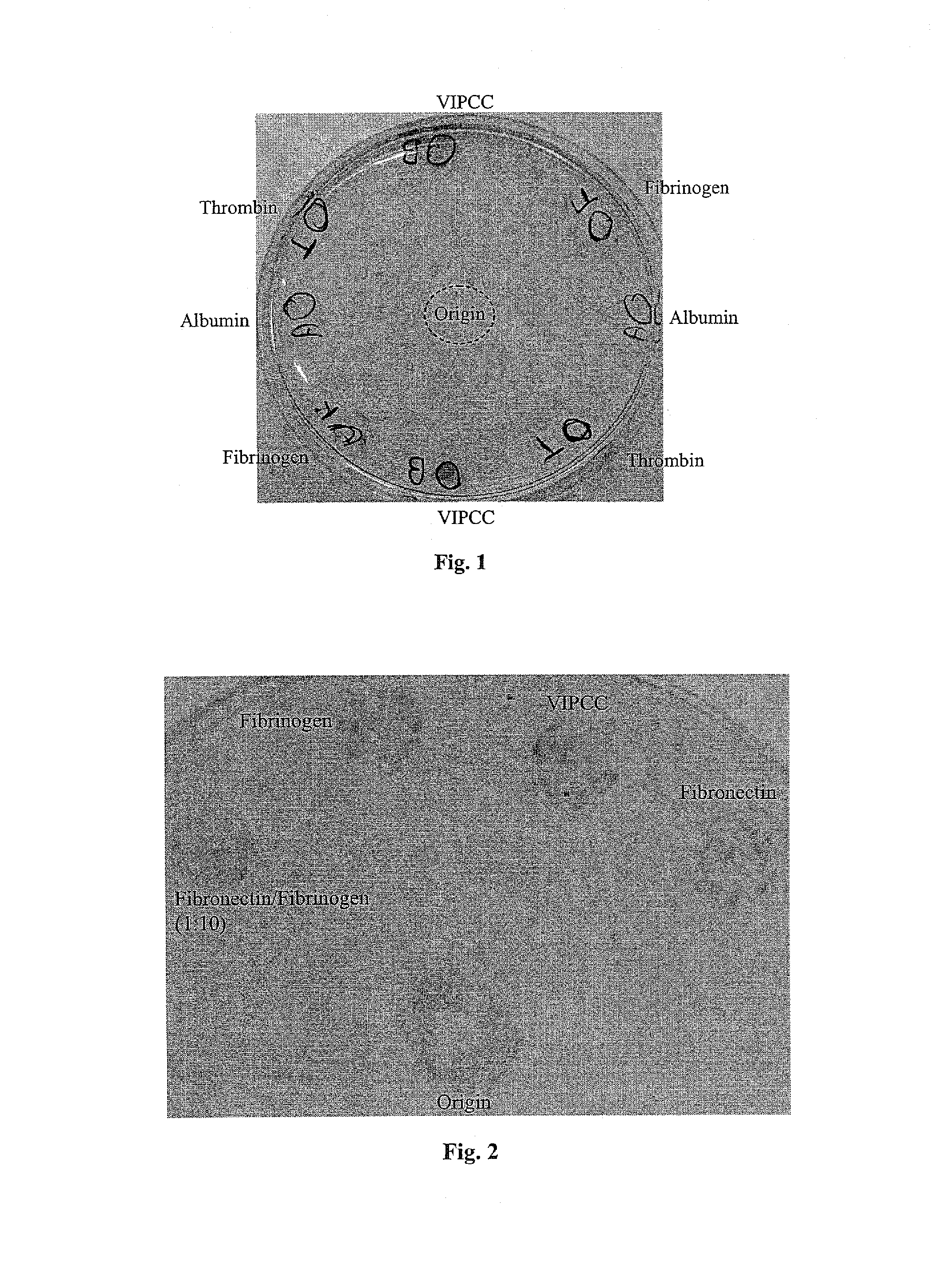 Compositions suitable for treatment of spinal disease, disorder or condition