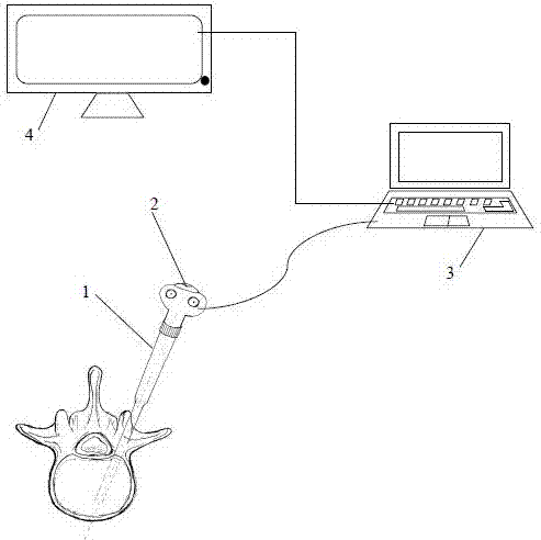 Non-radiation perspective visual navigation method and system for assisting orthopedic surgery